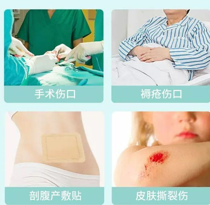 二类三类创面修复敷料、疤痕修复敷料、液体敷料、生物敷料CDMO服务