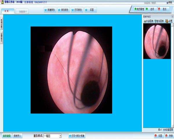 胆道镜图文工作站