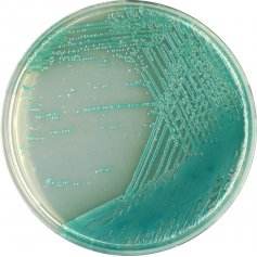 法国科玛嘉铜绿假单胞菌显色培养基