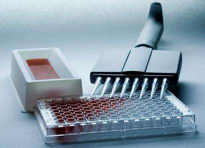 人甲种胎儿球蛋白/甲胎蛋白elisa代测,AFP试剂盒
