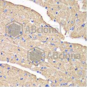 VDAC1 Polyclonal Antibody