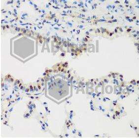 PCNA Polyclonal Antibody