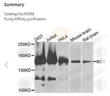 BCR Polyclonal Antibody