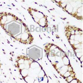 PCNA Polyclonal Antibody