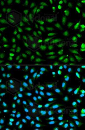 PCNA Polyclonal Antibody