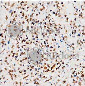 HIST3H3 Polyclonal Antibody