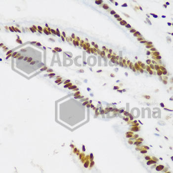 PCNA Polyclonal Antibody