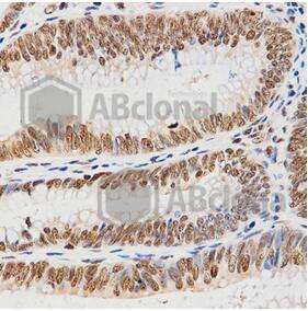 HIST3H3 Polyclonal Antibody