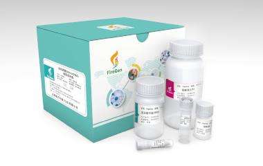 血液RNA提取试剂盒（EDTA血）