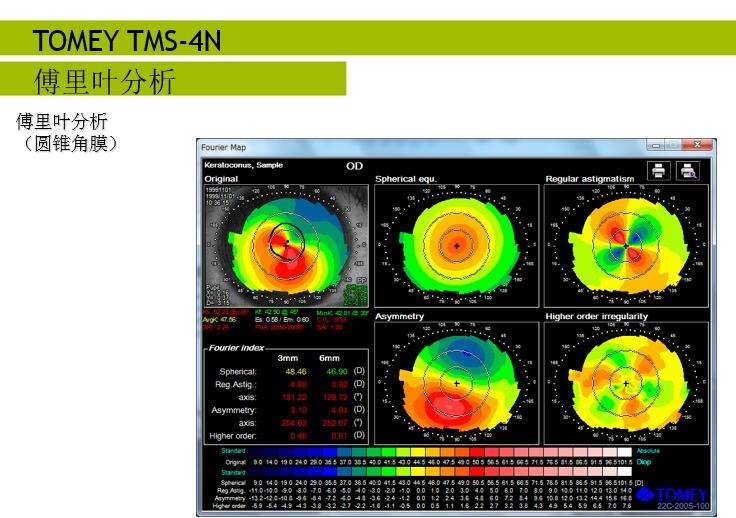 日本多美Tomey TMS-4N角膜地形图仪