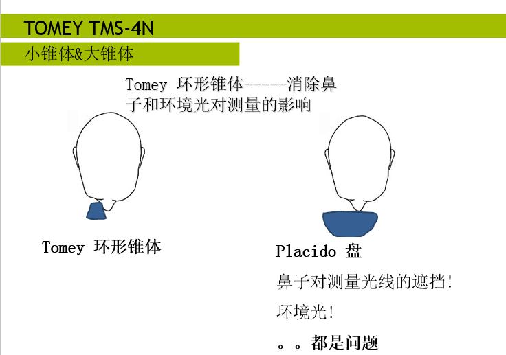 日本多美Tomey TMS-4N角膜地形图仪