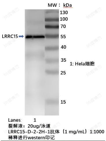 LRRC15抗体