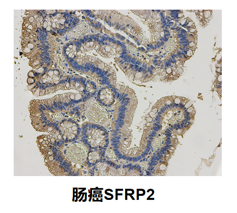 SFRP2抗体