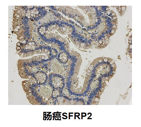 SFRP2抗体