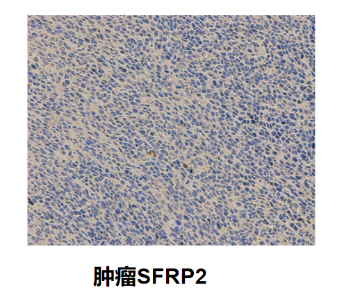 SFRP2抗体