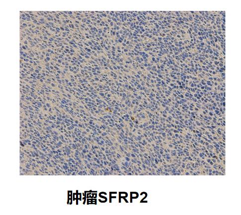 SFRP2抗体