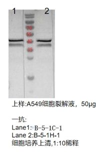 SIRT2抗体