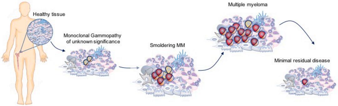 多发性骨髓瘤(Multiple Myeloma, MM)靶点人源化小鼠及细胞系